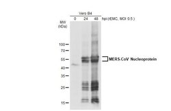 Invitrogen MERS Coronavirus NP Polyclonal Antibody 100 &mu;L; Unconjugated:Antibodies,