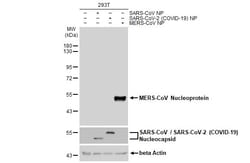 Invitrogen MERS Coronavirus NP Polyclonal Antibody 100 &mu;L; Unconjugated:Antibodies,
