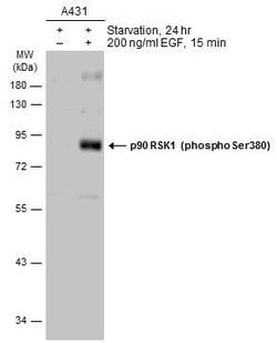 Invitrogen Phospho-RSK1 (Ser380) Polyclonal Antibody 100 &mu;L; Unconjugated:Antibodies,