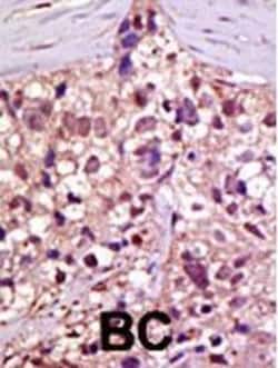 Invitrogen UBE1 Polyclonal Antibody 400 &mu;L; Unconjugated:Antibodies,