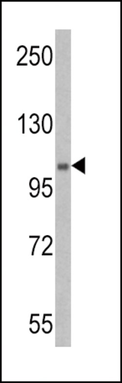 Invitrogen UBE1 Polyclonal Antibody 400 &mu;L; Unconjugated:Antibodies,