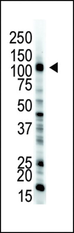 Invitrogen UBE1 Polyclonal Antibody 400 &mu;L; Unconjugated:Antibodies,