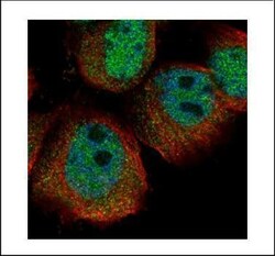 Invitrogen RPS27A Polyclonal Antibody 100 &mu;L; Unconjugated:Antibodies,