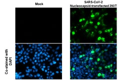 Invitrogen&trade;&nbsp;SARS/SARS-CoV-2 Nucleocapsid Polyclonal Antibody