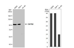 Invitrogen SATB2 Polyclonal Antibody 100 &mu;L; Unconjugated:Antibodies,