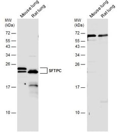 Invitrogen SFTPC Polyclonal Antibody 100 &mu;L; Unconjugated:Antibodies,