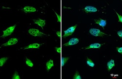 SIRT1 Polyclonal Antibody:Antibodies, Polyclonal
