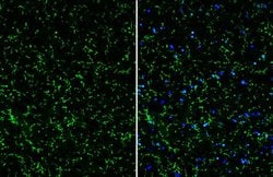 Invitrogen TMEM119 Polyclonal Antibody 100 &mu;L; Unconjugated:Antibodies,