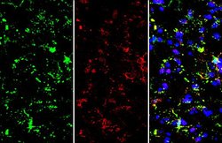 Invitrogen TMEM119 Polyclonal Antibody 100 &mu;L; Unconjugated:Antibodies,