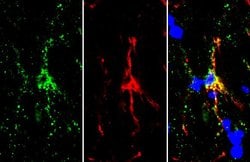 Invitrogen TMEM119 Polyclonal Antibody 100 &mu;L; Unconjugated:Antibodies,