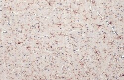 Invitrogen TMEM119 Polyclonal Antibody 100 &mu;L; Unconjugated:Antibodies,