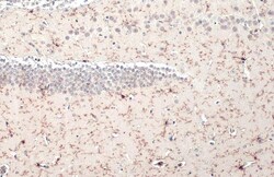 Invitrogen TMEM119 Polyclonal Antibody 100 &mu;L; Unconjugated:Antibodies,