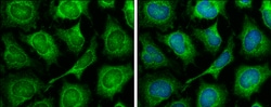 Invitrogen TOMM7 Polyclonal Antibody 100 &mu;L; Unconjugated:Antibodies,