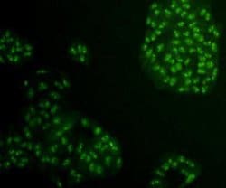Invitrogen HMGB1 Polyclonal Antibody 100 &mu;L; Unconjugated:Antibodies,