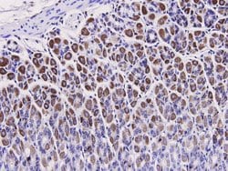 Invitrogen HMGB1 Polyclonal Antibody 100 &mu;L; Unconjugated:Antibodies,