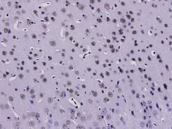 Invitrogen HMGB1 Polyclonal Antibody 100 &mu;L; Unconjugated:Antibodies,