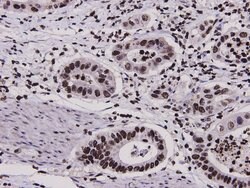 Invitrogen HMGB1 Polyclonal Antibody 100 &mu;L; Unconjugated:Antibodies,
