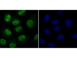Invitrogen Cdc25C Polyclonal Antibody 100 &mu;L; Unconjugated:Antibodies,