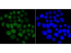 Invitrogen Cdc25C Polyclonal Antibody 100 &mu;L; Unconjugated:Antibodies,