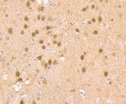 Invitrogen Cdc25C Polyclonal Antibody 100 &mu;L; Unconjugated:Antibodies,