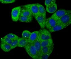 Invitrogen ROCK2 Polyclonal Antibody 100 &mu;L; Unconjugated:Antibodies,
