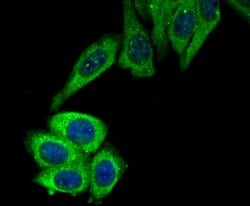 Invitrogen ROCK2 Polyclonal Antibody 100 &mu;L; Unconjugated:Antibodies,