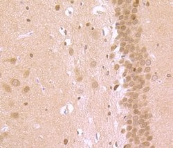 Invitrogen ROCK2 Polyclonal Antibody 100 &mu;L; Unconjugated:Antibodies,