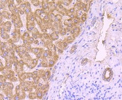 Invitrogen ROCK2 Polyclonal Antibody 100 &mu;L; Unconjugated:Antibodies,