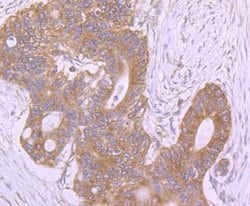 Invitrogen ROCK2 Polyclonal Antibody 100 &mu;L; Unconjugated:Antibodies,
