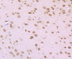 Invitrogen ROCK2 Polyclonal Antibody 100 &mu;L; Unconjugated:Antibodies,