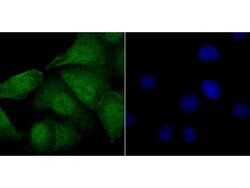 Invitrogen FOXM1 Polyclonal Antibody 100 &mu;L | Buy Online | Invitrogen&trade; | Fisher Scientific