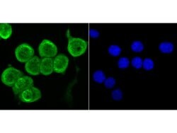Invitrogen Fyn Polyclonal Antibody 100 &mu;L; Unconjugated:Antibodies,