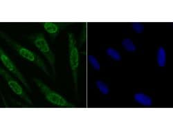Invitrogen Fyn Polyclonal Antibody 100 &mu;L; Unconjugated:Antibodies,