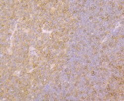 Invitrogen Fyn Polyclonal Antibody 100 &mu;L; Unconjugated:Antibodies,