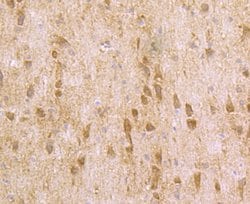 Invitrogen Fyn Polyclonal Antibody 100 &mu;L; Unconjugated:Antibodies,