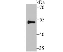 Invitrogen Fyn Polyclonal Antibody 100 &mu;L; Unconjugated:Antibodies,