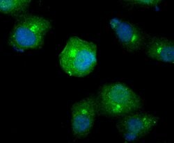 Invitrogen SMAD4 Polyclonal Antibody 100 &mu;L; Unconjugated:Antibodies,