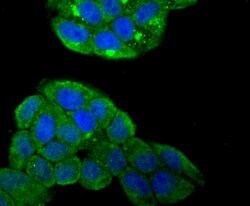 Invitrogen SMAD4 Polyclonal Antibody 100 &mu;L; Unconjugated:Antibodies,