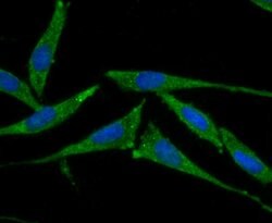 Invitrogen SMAD4 Polyclonal Antibody 100 &mu;L; Unconjugated:Antibodies,
