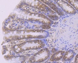 Invitrogen SMAD4 Polyclonal Antibody 100 &mu;L; Unconjugated:Antibodies,