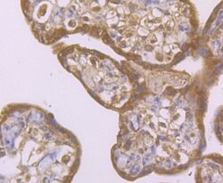 Invitrogen SMAD4 Polyclonal Antibody 100 &mu;L; Unconjugated:Antibodies,