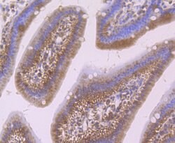 Invitrogen SMAD4 Polyclonal Antibody 100 &mu;L; Unconjugated:Antibodies,