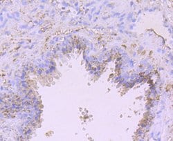 Invitrogen ADAM10 Polyclonal Antibody 100 μL; Unconjugated:Antibodies,