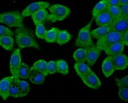 Invitrogen beta Arrestin 1 Polyclonal Antibody 100 &mu;L; Unconjugated:Antibodies,