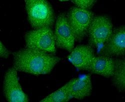 Invitrogen beta Arrestin 1 Polyclonal Antibody 100 &mu;L; Unconjugated:Antibodies,