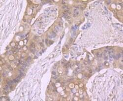 Invitrogen beta Arrestin 1 Polyclonal Antibody 100 &mu;L; Unconjugated:Antibodies,