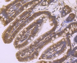 Invitrogen beta Arrestin 1 Polyclonal Antibody 100 &mu;L; Unconjugated:Antibodies,