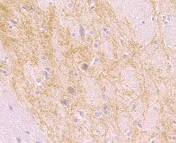 Invitrogen beta Arrestin 1 Polyclonal Antibody 100 &mu;L; Unconjugated:Antibodies,