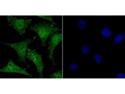 Invitrogen SATB1 Polyclonal Antibody 100 &mu;L; Unconjugated:Antibodies,