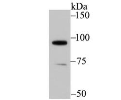 Invitrogen SATB1 Polyclonal Antibody 100 &mu;L; Unconjugated:Antibodies,